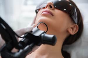 Close up of ladies laser fractional resurfacing