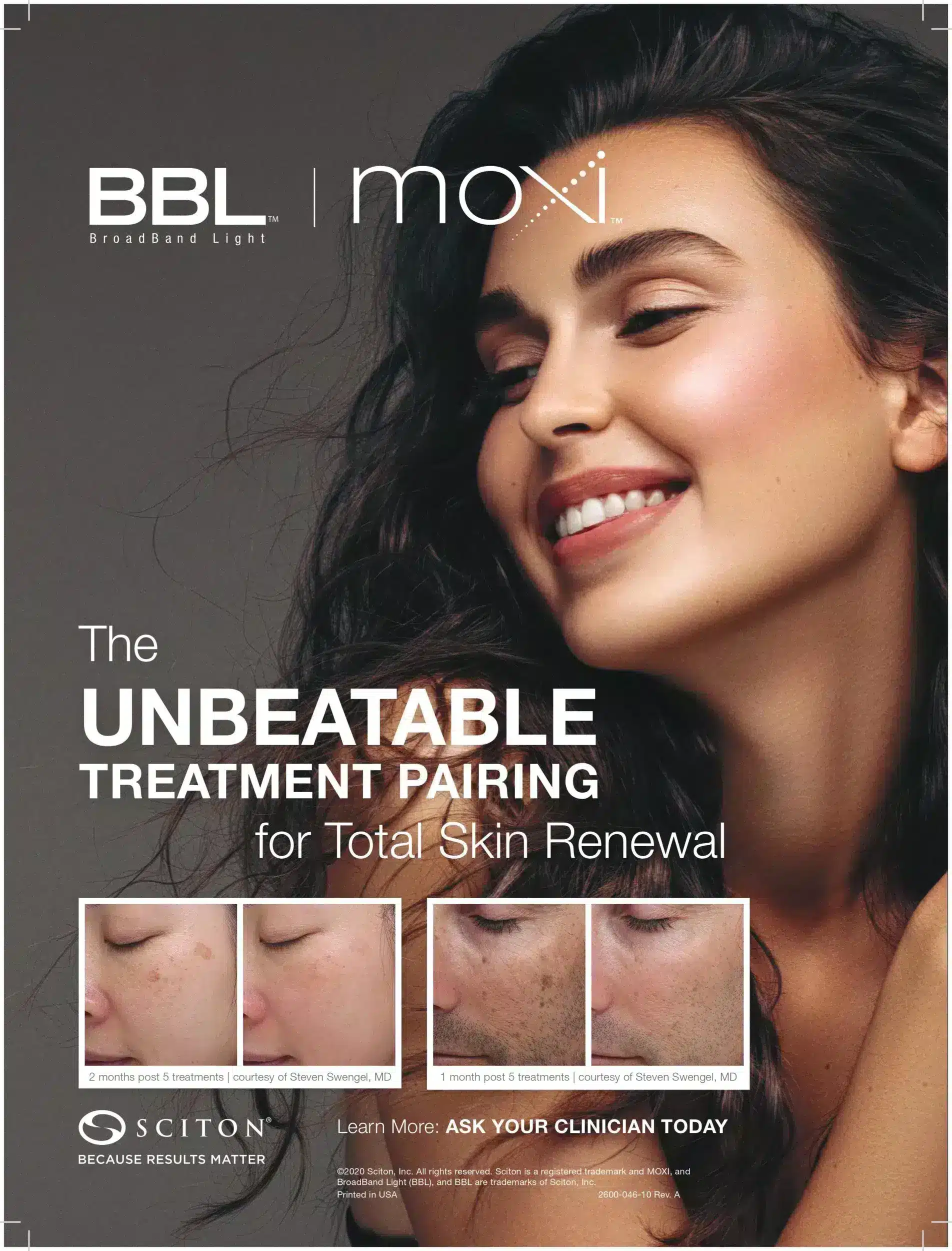 BBL Broadband Light/BBL Hero