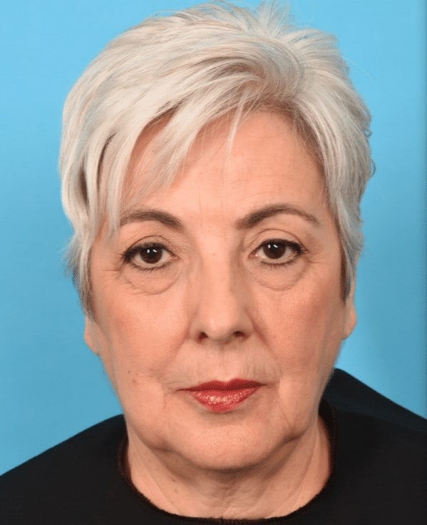 5407e21174ab8e2c406b56c57e1c4b67 Before Instalift Hauppauge NY