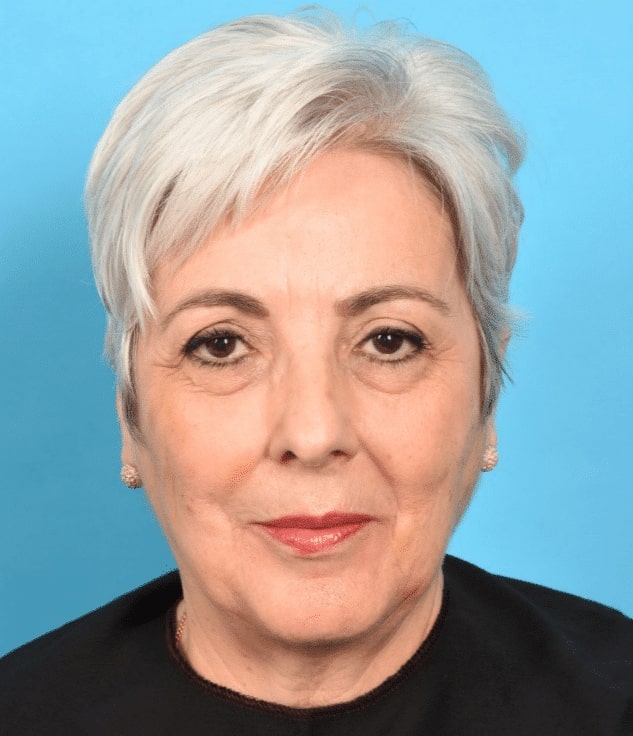 46aa5edc1be6f6f09cfe6d3e665273cb After Instalift Hauppauge NY